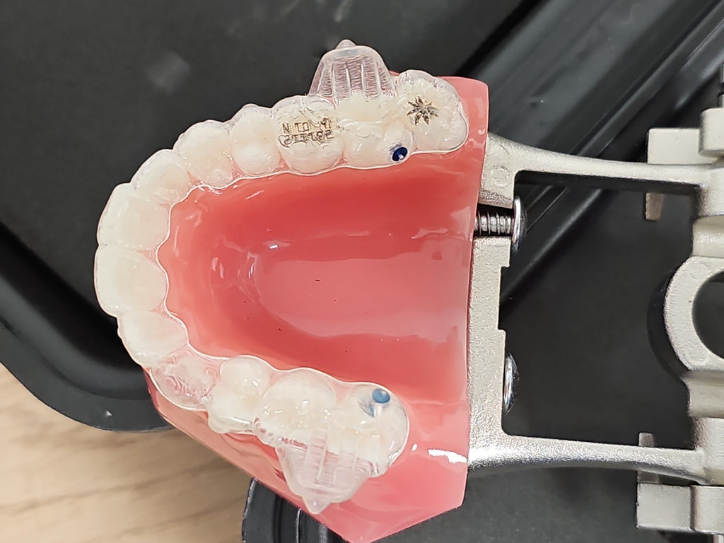 Modèle dentaire démonstration Invisalign écarteur joue typodont orthodontie